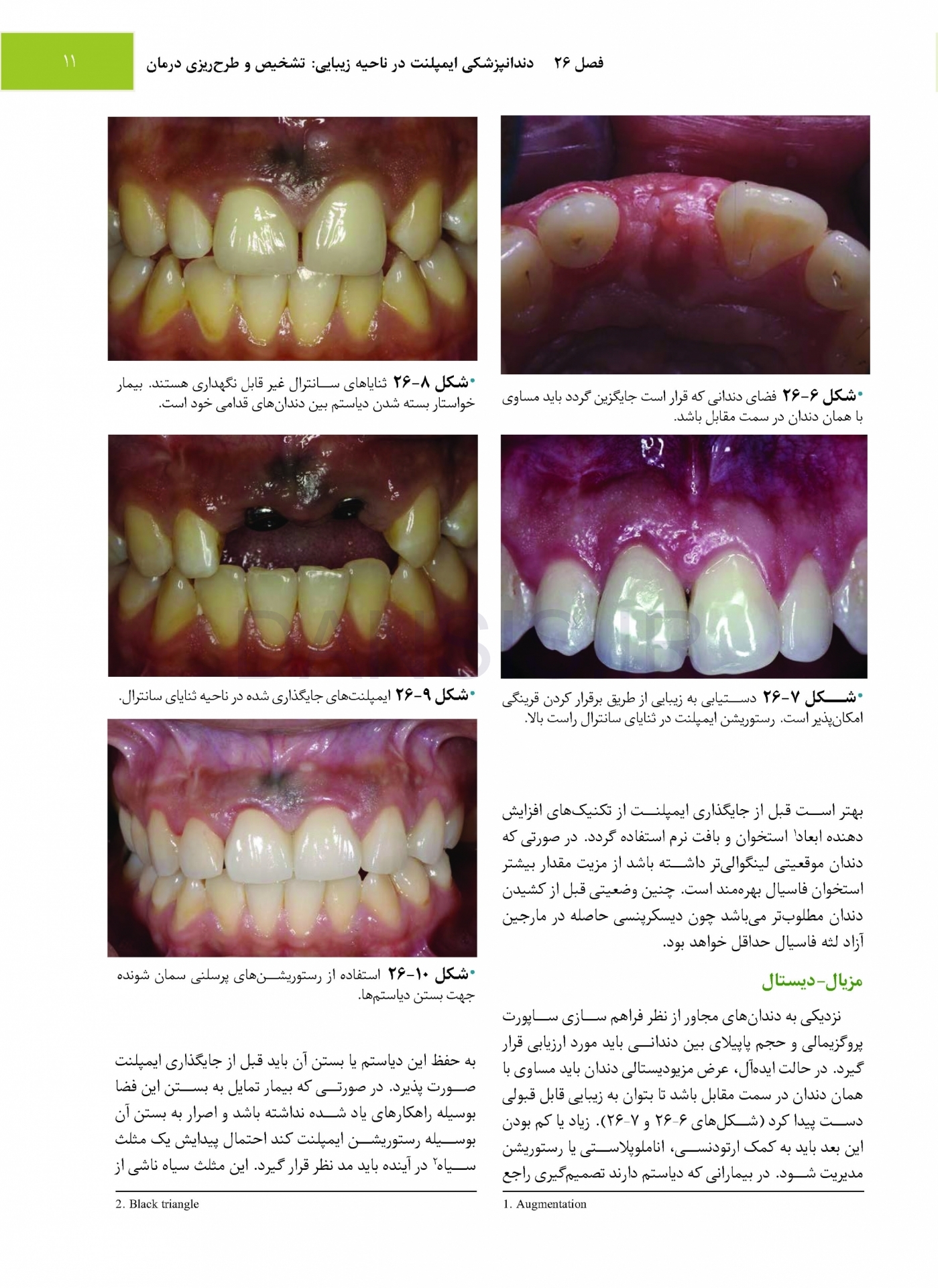 تصویر  جراحی، دهان و فک و صورت فونسکا 2018 جلد پنجم (جراحی ایمپلنت)