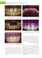 تصویر  جراحی، دهان و فک و صورت فونسکا 2018 جلد پنجم (جراحی ایمپلنت)