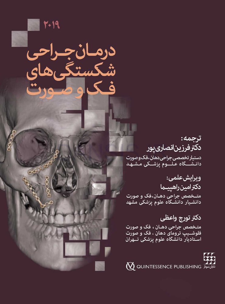 تصویر  درمان جراحی شکستگی های فک و صورت 2019