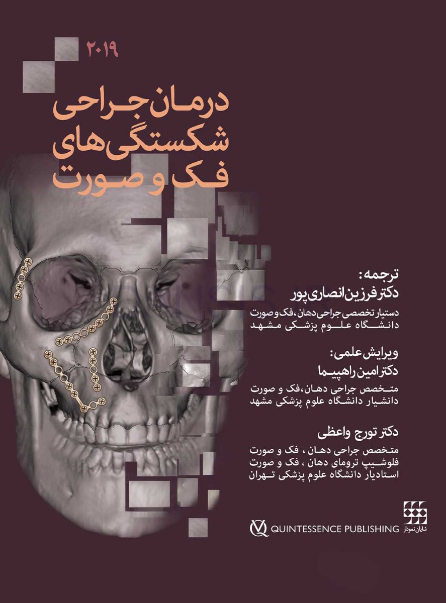 تصویر  درمان جراحی شکستگی های فک و صورت 2019