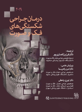 تصویر  درمان جراحی شکستگی های فک و صورت 2019