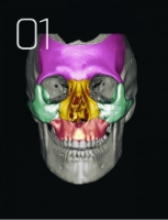 تصویر  درمان جراحی شکستگی های فک و صورت 2019