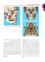 تصویر  درمان جراحی شکستگی های فک و صورت 2019