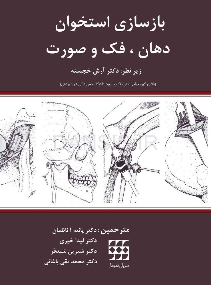 تصویر  بازسازی استخوان دهان، فک و صورت
