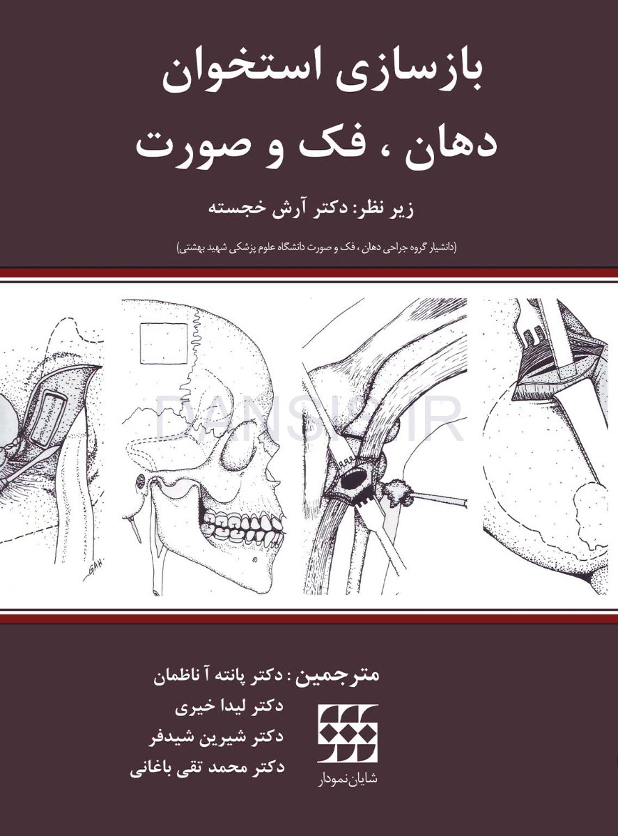 تصویر  بازسازی استخوان دهان، فک و صورت