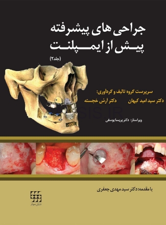 تصویر  جراحی های پیشرفته پیش از ایمپلنت (جلد 2)
