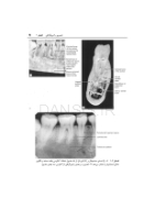 تصویر  ضروریات رادیوگرافی دندانپزشکی