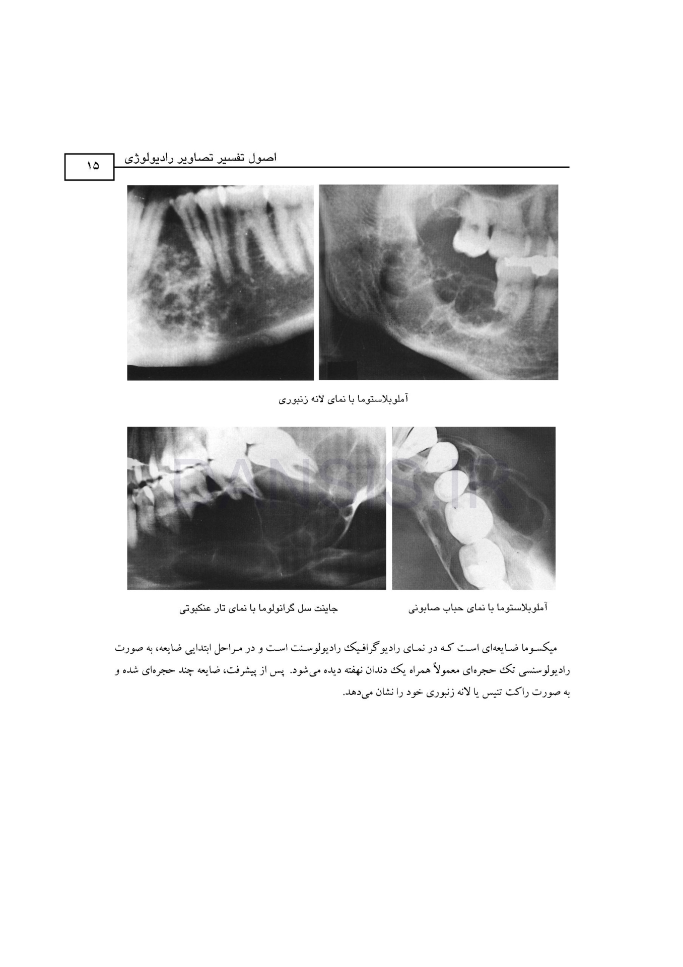 تصویر  اطلس رادیولوژی دهان و فک و صورت