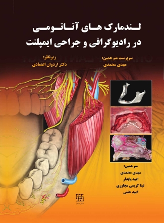 تصویر  لندمارک های آناتومی در رادیوگرافی و جراحی ایمپلنت