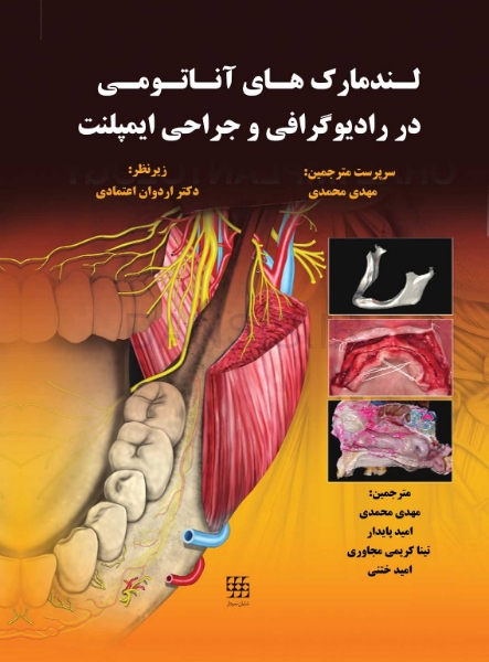 تصویر  لندمارک های آناتومی در رادیوگرافی و جراحی ایمپلنت