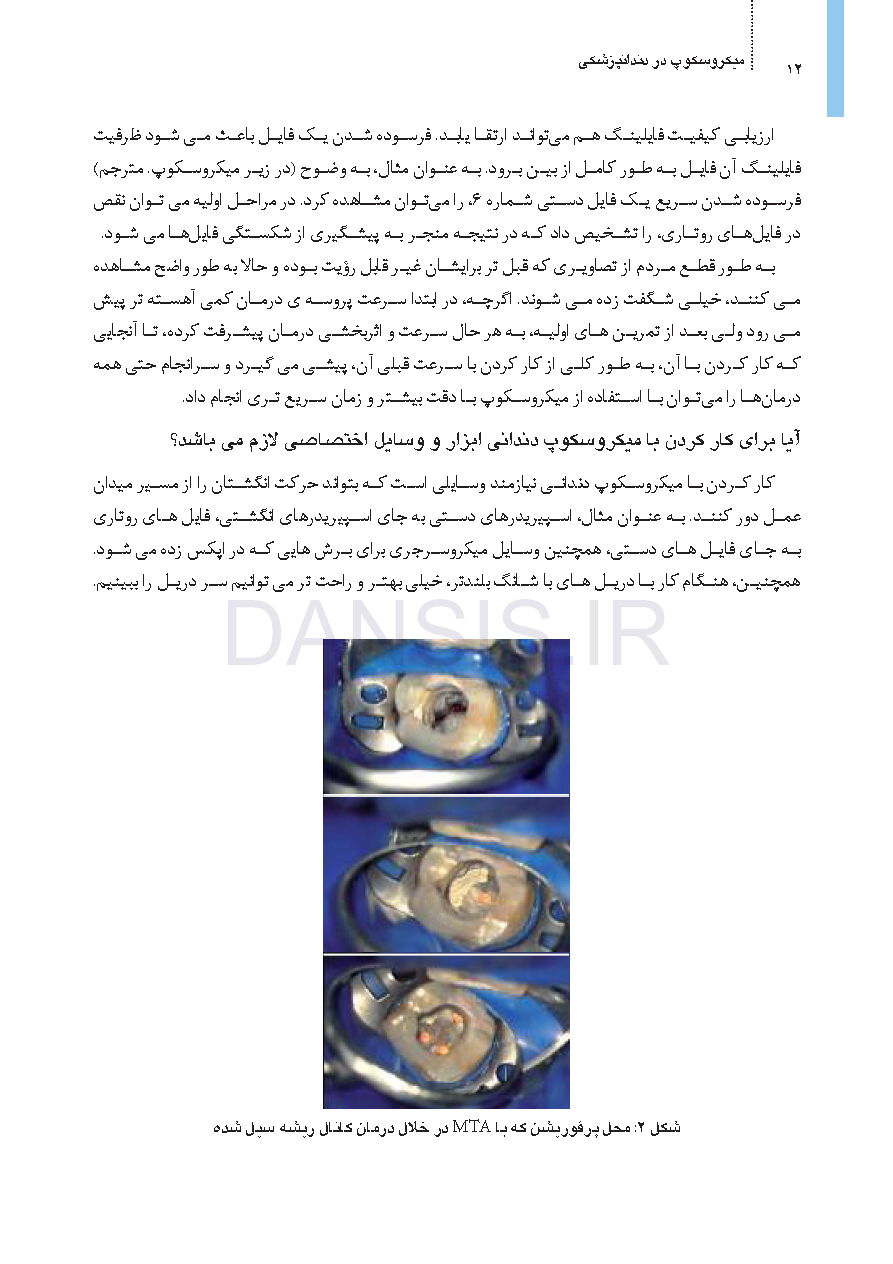 تصویر  میکروسکوپ در دندانپزشکی (یک مقاله گروهی برای دندانپزشکان حرفه ای)