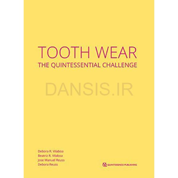 تصویر  Tooth Wear: The Quintessential Challenge 2023