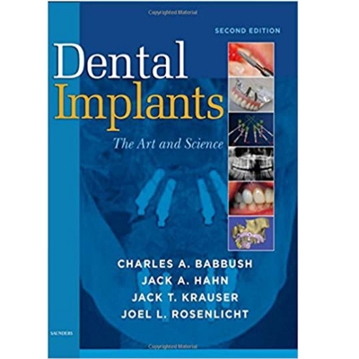 تصویر  Dental Implant the art and science