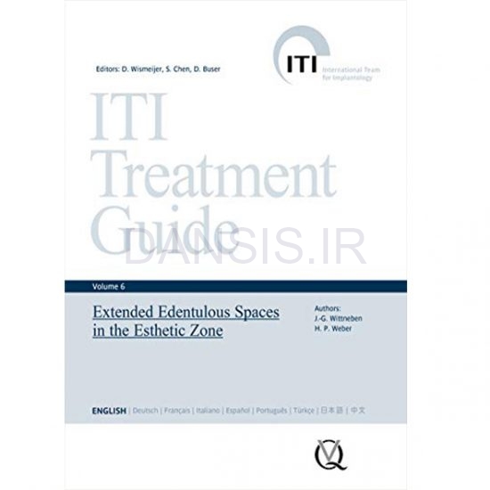 تصویر  ITI Treatment Guid – Volume 6—Extended Edentulous Spaces in the Esthetic Zone