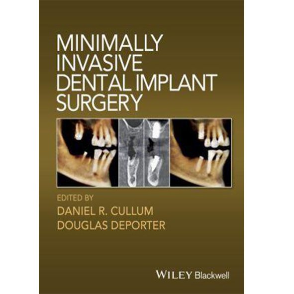 تصویر  minimally invasive dental implant surgery