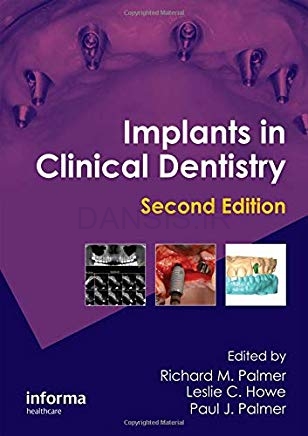 تصویر  Implant in Clinical Dentistry