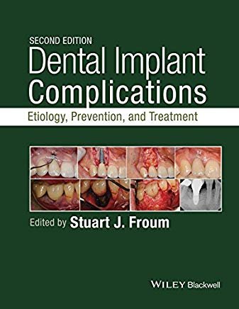 تصویر  Dental Implant Complications Etiology, Prevention, and Treatment