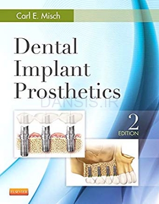 تصویر  Dental implant prostodontics