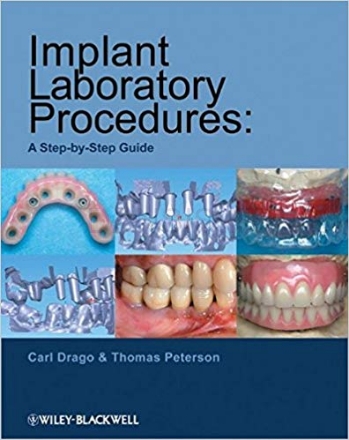 تصویر  Implant Laboratory Procedures: A Step-by-Step Guide