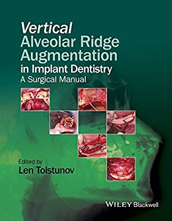 تصویر  Vertical Alveolar Ridge Augmentation Implant Dentistry a surgical manual