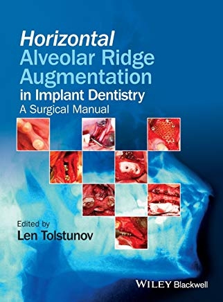 تصویر  Horizontal Alveolar Ridge Augmentation in Implant Dentistry a surgical manual