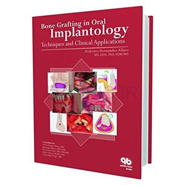 تصویر  Bone Grafting in Oral Implantology