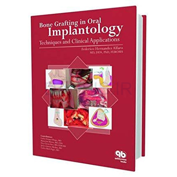 تصویر  Bone Grafting in Oral Implantology
