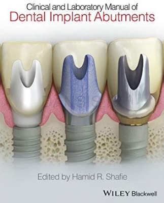 تصویر  Clinical and Laboratory Manual of Dental Implant Abutments