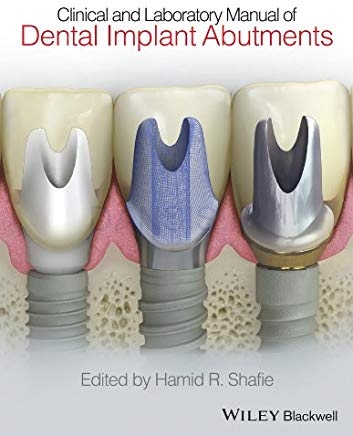 تصویر  Clinical and Laboratory Manual of Dental Implant Abutments