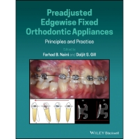 تصویر  Preadjusted Edgewise Fixed Orthodontic Appliances 2022
