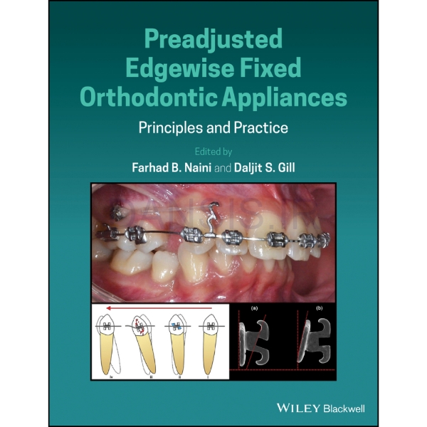 تصویر  Preadjusted Edgewise Fixed Orthodontic Appliances 2022