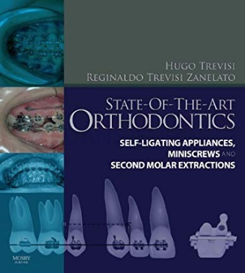 تصویر  State-of-the-Art Orthodontics: Self-Ligating Appliances, Miniscrews and Second Molars Extraction