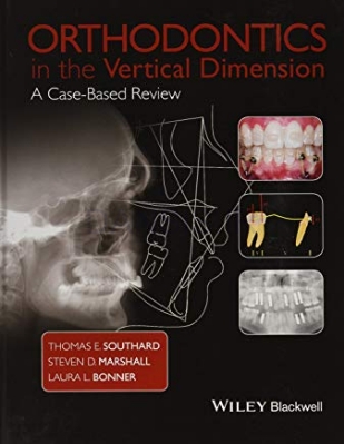 تصویر  Orthodontics in the Vertical Dimension A Case‐Based Review