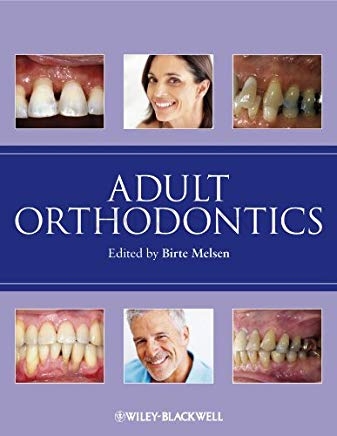 تصویر  Adult Orthodontics