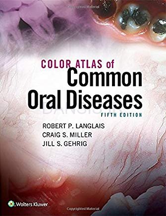 تصویر  Color Atlas of Common Oral Diseases