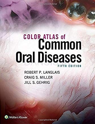 تصویر  Color Atlas of Common Oral Diseases