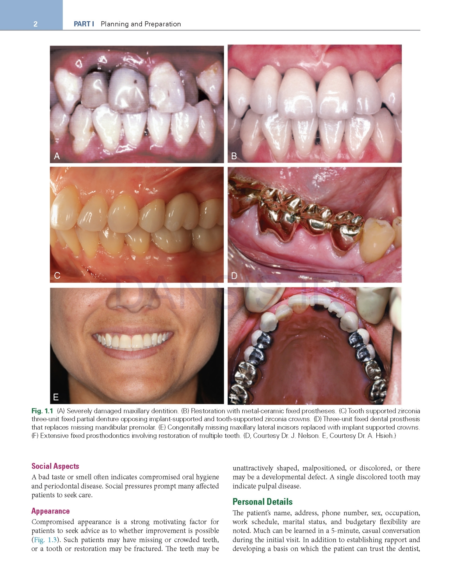 تصویر  Contemporary Fixed Prosthodontics 6e 2023