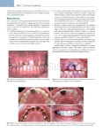 تصویر  Contemporary Fixed Prosthodontics 6e 2023
