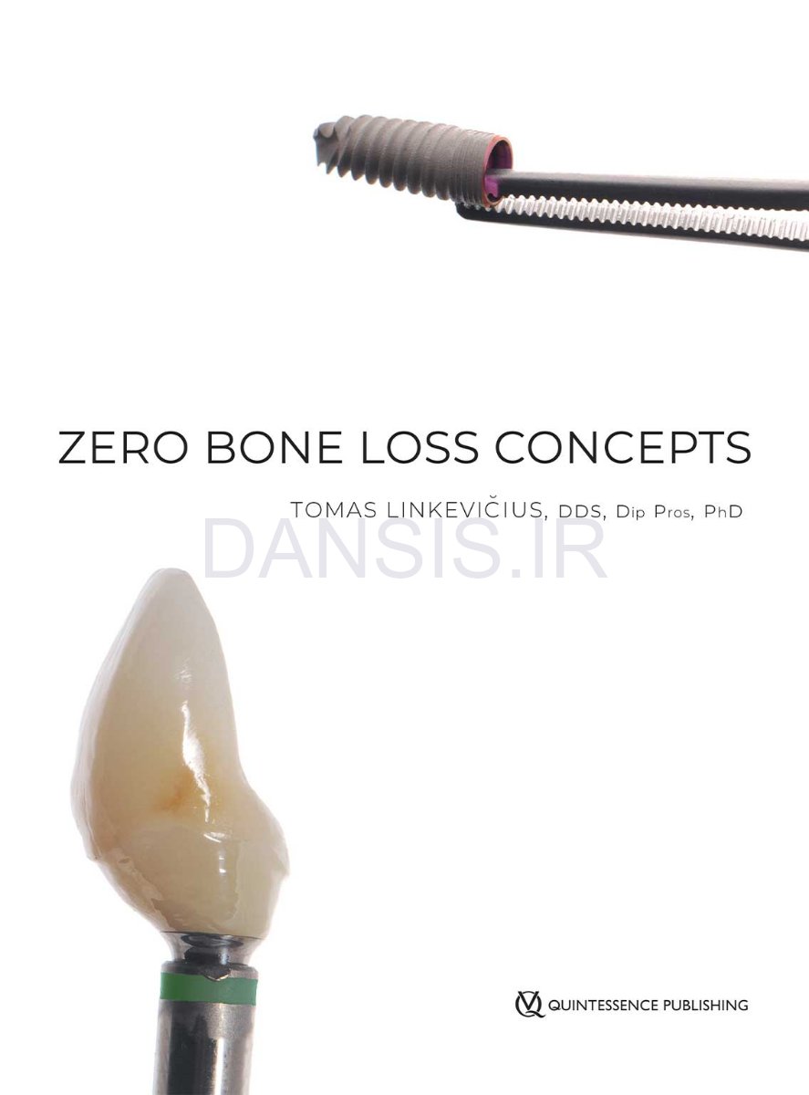تصویر  Zero Bone Loss Concepts