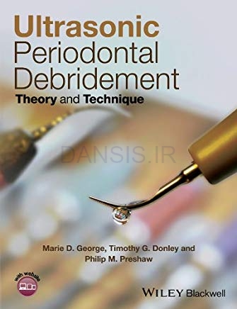 تصویر  Ultrasonic Periodontal Debridement