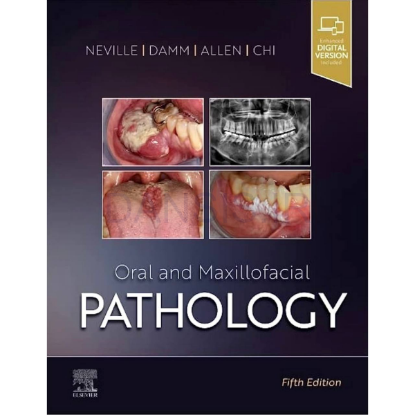 تصویر  Oral and Maxillofacial Pathology(NEVILLE) 2024