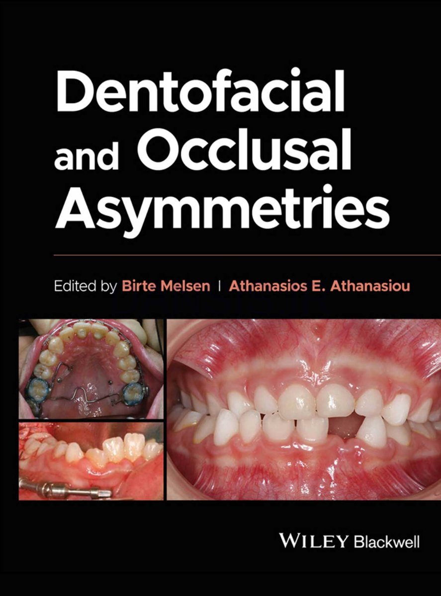 تصویر  Dentofacial and Occlusal Asymmetries 2025