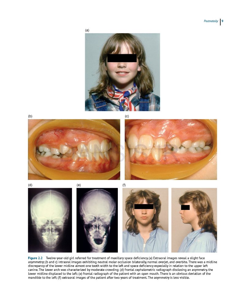 تصویر  Dentofacial and Occlusal Asymmetries 2025