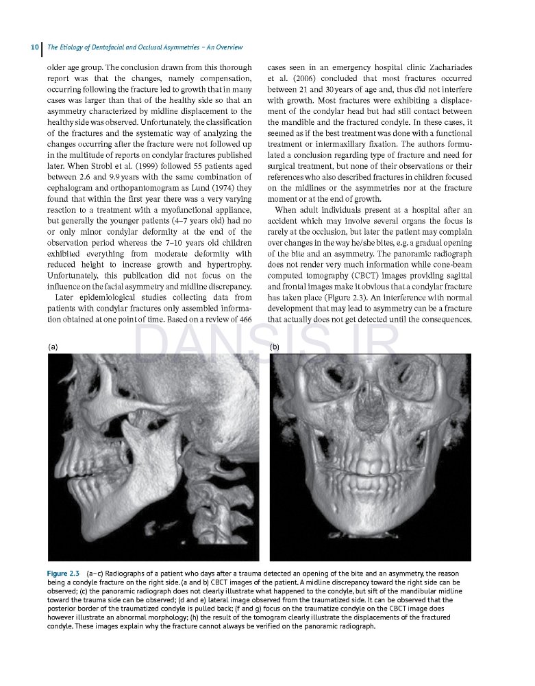 تصویر  Dentofacial and Occlusal Asymmetries 2025