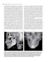 تصویر  Dentofacial and Occlusal Asymmetries 2025