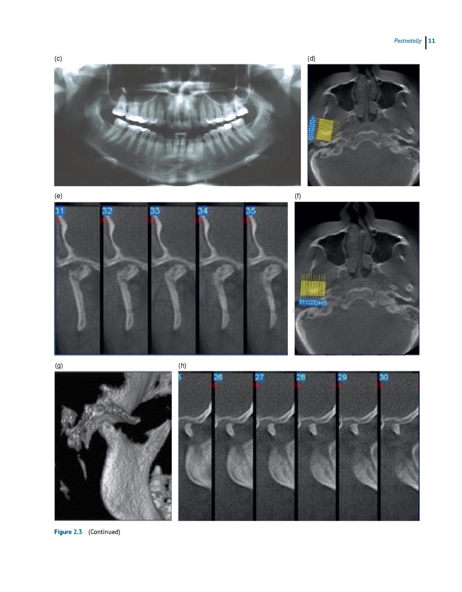 تصویر  Dentofacial and Occlusal Asymmetries 2025