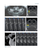 تصویر  Dentofacial and Occlusal Asymmetries 2025