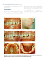 تصویر  Dentofacial and Occlusal Asymmetries 2025