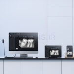 تصویر  سنسور RVG مدل ISensor