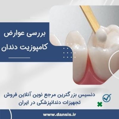 بررسی عوارض کامپوزیت دندان